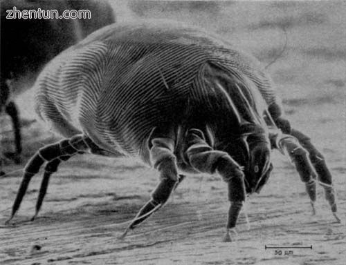 The house dust mite, its feces and chitin are common allergens around the home