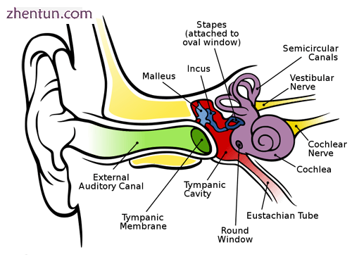 This is what a NORMAL ear looks like without a hole in the tympanic membrane (eardrum).