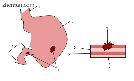 1. Esophagus