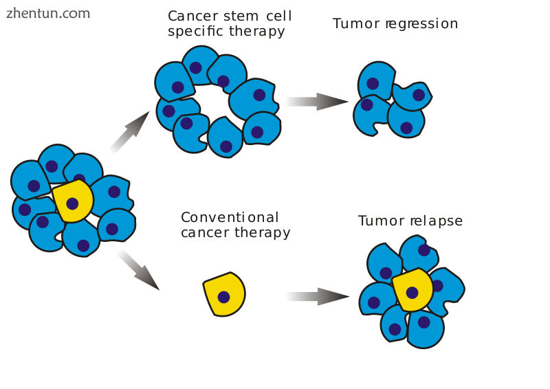 A diagram illustrating the distinction between cancer stem cell targeted and conventional cancer the ...
