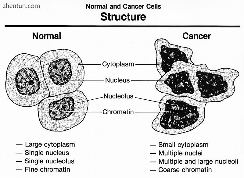 Histological features of normal cells and cancer cells