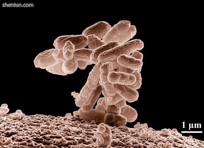 A cluster of Escherichia coli bacteria magnified 10,000 times.jpg