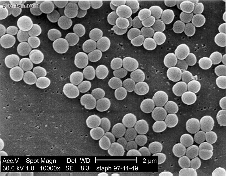 Staphylococcus aureus bacteria magnified about 10,000x.jpg