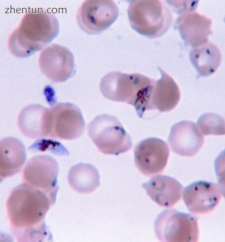 The eukaryotic parasite Plasmodium falciparum (spiky blue shapes), a causative a.jpg