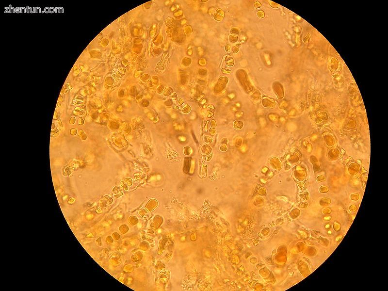 The photosynthetic cyanobacterium Hyella caespitosa (round shapes) with fungal h.jpg