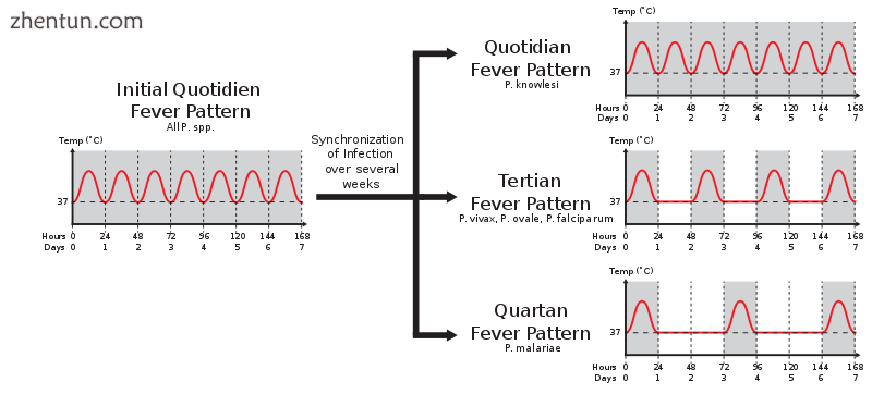 Different fever patterns observed in Plasmodium infections..png