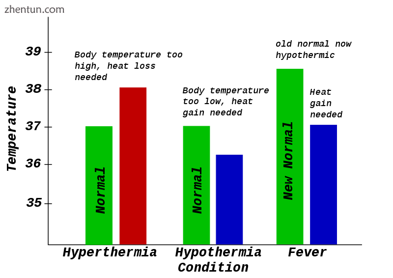 Hyperthermia.png