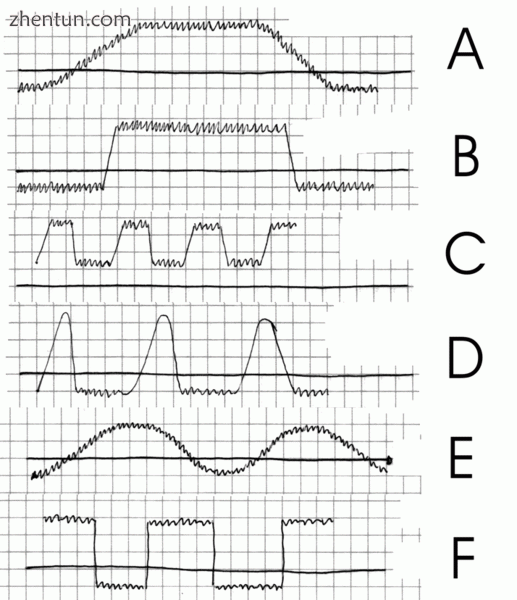 Performance of the various types of fever.gif