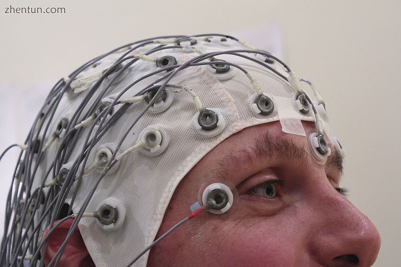 An EEG can aid in locating the focus of the epileptic seizure..jpg