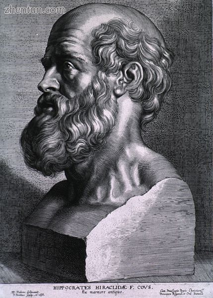 Hippocrates, 17th century engraving by Peter Paul Rubens of an antique bust..jpg