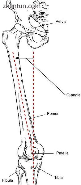 Femur with Q angle.jpg