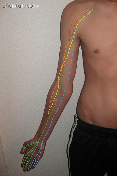 This image shows the anterior view of the 5 brachial plexus nerves on the human arm..JPG