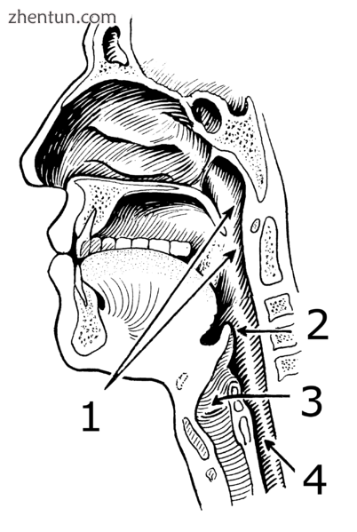 Sagittal illustration of the anterior portion of the human head and neck. In LPR.png