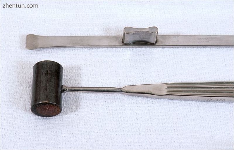 Rhinoplastic instruments An osteotome (bone chisel) and a surgical hammer for sc.jpg