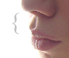 Rhinoplasty. Nasal anatomy The philtrum..jpg