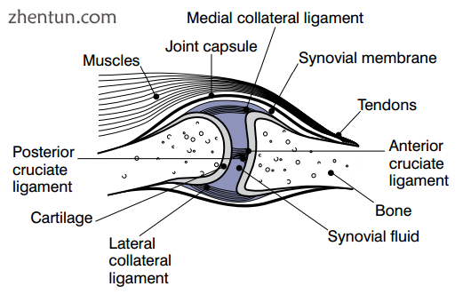 In a healthy joint, the ends of bones are encased in smooth cartilage..png