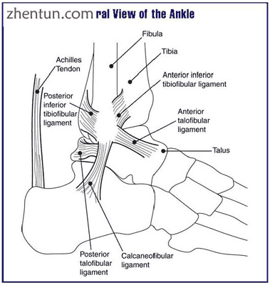 Lateral view of the human ankle, including the talus.PNG