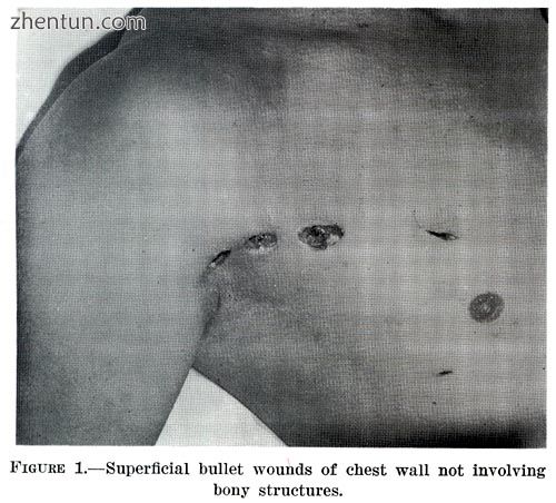 A gunshot wound.jpg