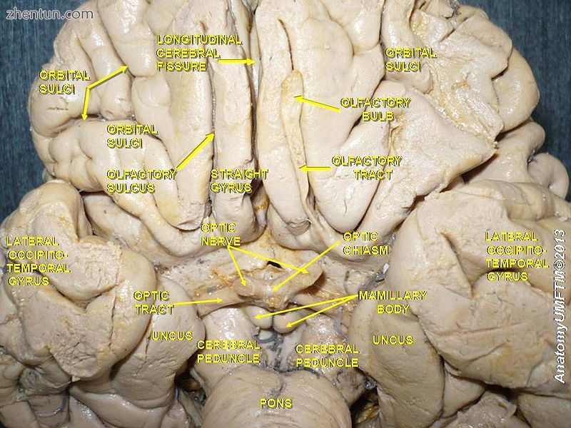 Olfactory nerve. Deep dissection. Inferior view..JPG