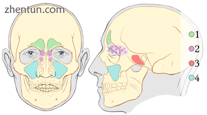 Paranasal sinuses 1..png