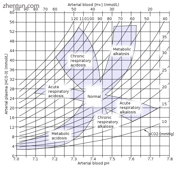 An acid base nomogram for human plasma, showing the effects on the plasma pH whe.png