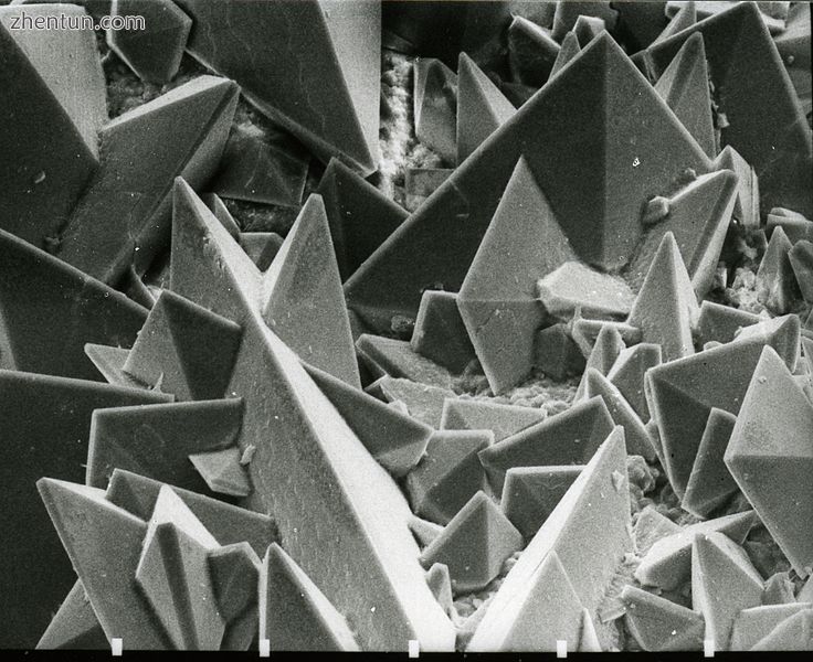 Scanning electron micrograph of the surface of a kidney.jpg