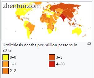 Urolithiasis deaths per million persons in 2012.jpg