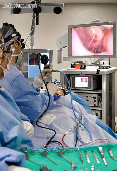 Otolaryngologist performing Functional Endoscopic Sinus Surgery. An endoscopic v.jpg