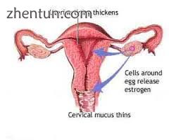 diagram showing leukorrhea infection.jpg