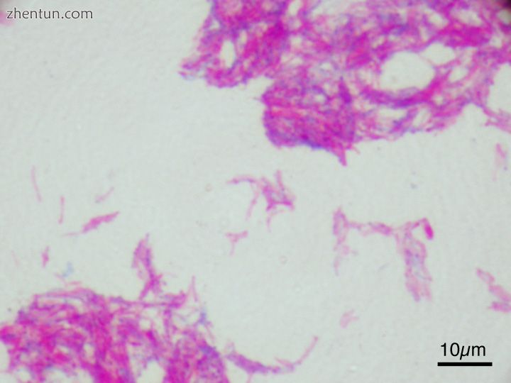 Attenuated strain of M. bovis used in the treatment of bladder cancer.jpg