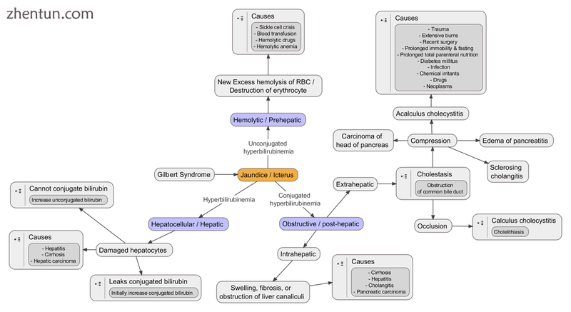 Types of jaundice.png