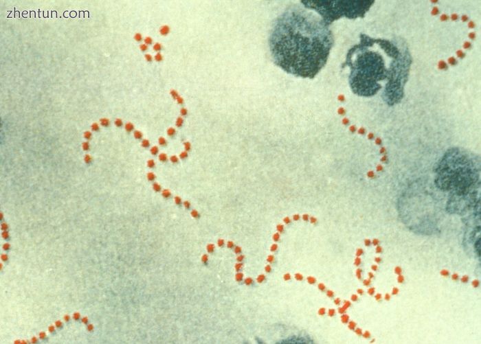 Streptococcus pyogenes (pictured).jpg