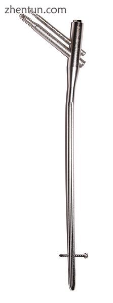 Proximal femur nail with locking and stabilisation screws for treatment of femur.jpg