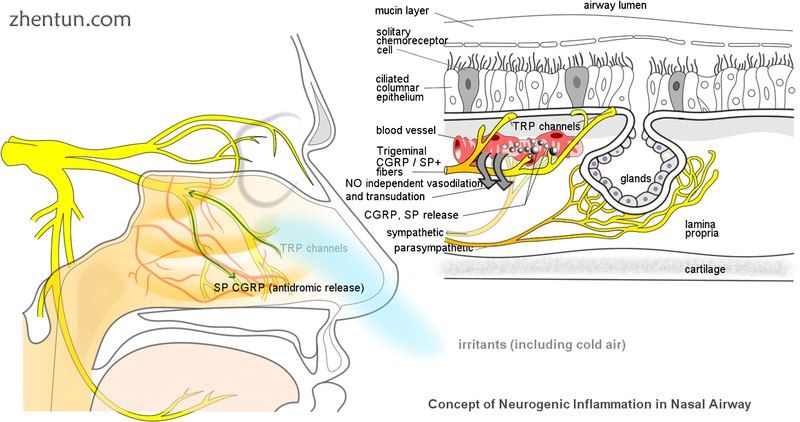 Mechanism of non-allergic rhinitis  Imbalance between sympathetic and parasympat.jpg