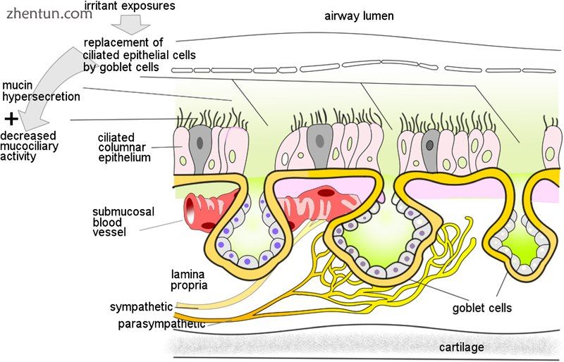 Pathological changes in non-allergic rhinitis[24].jpg