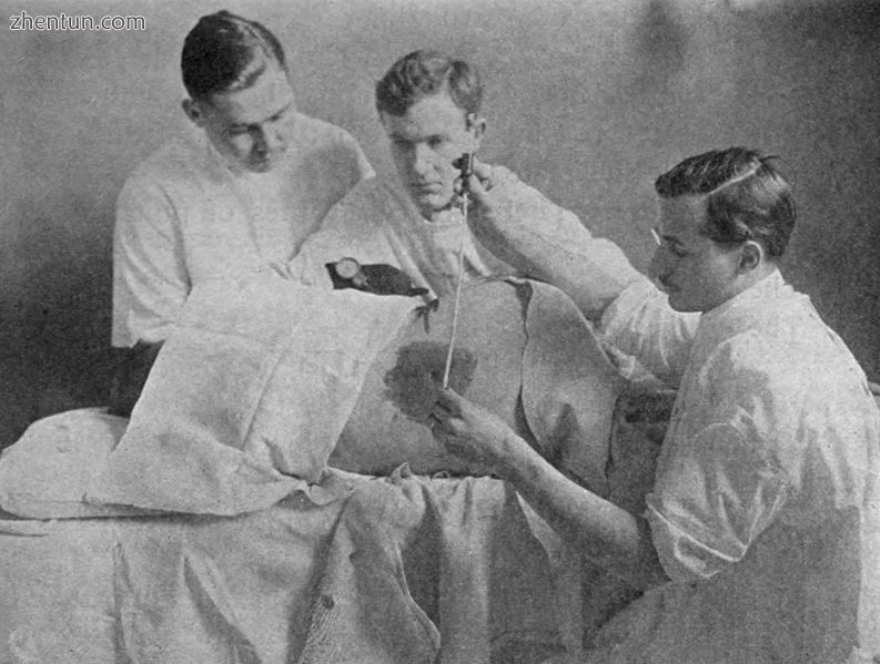 Lumbar puncture, early 20th century..jpg