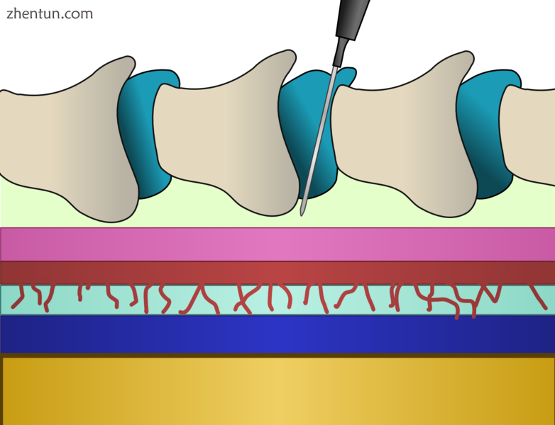 Sagittal section of the spinal column (not drawn to scale). The spinal cord (yel.png