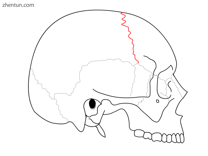 Coronal suture.png