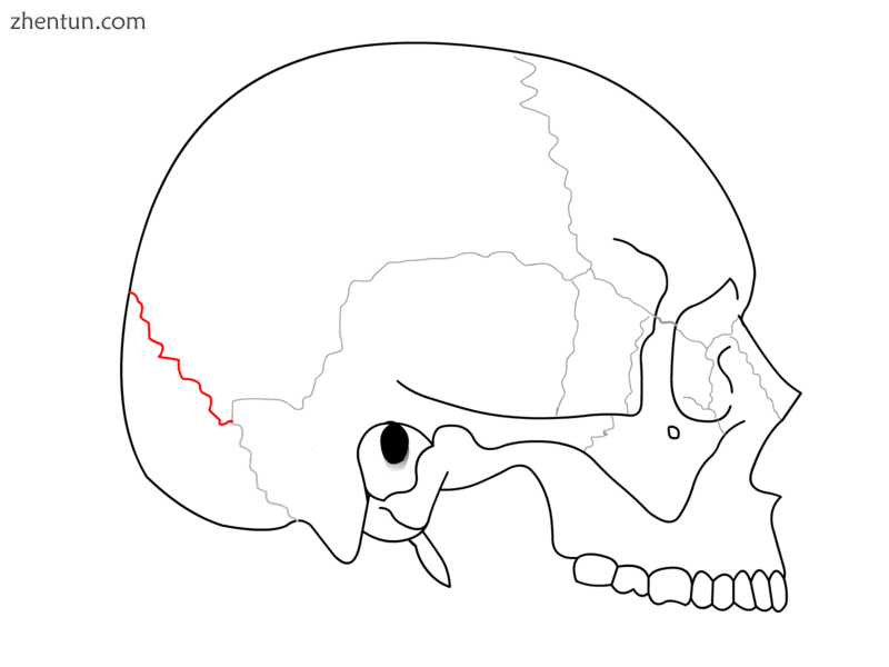 Lambdoid suture.png