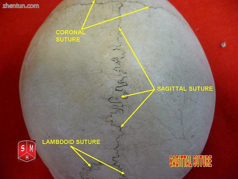 Sagittal suture.2.jpg