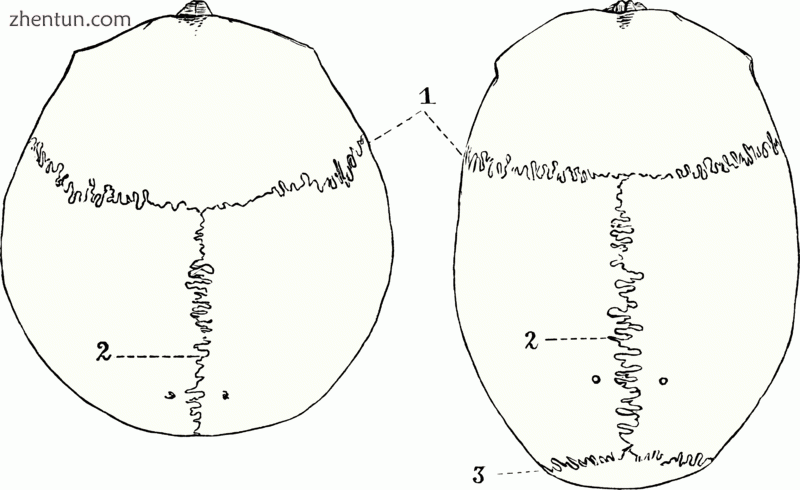 Top view of cranial suture..gif