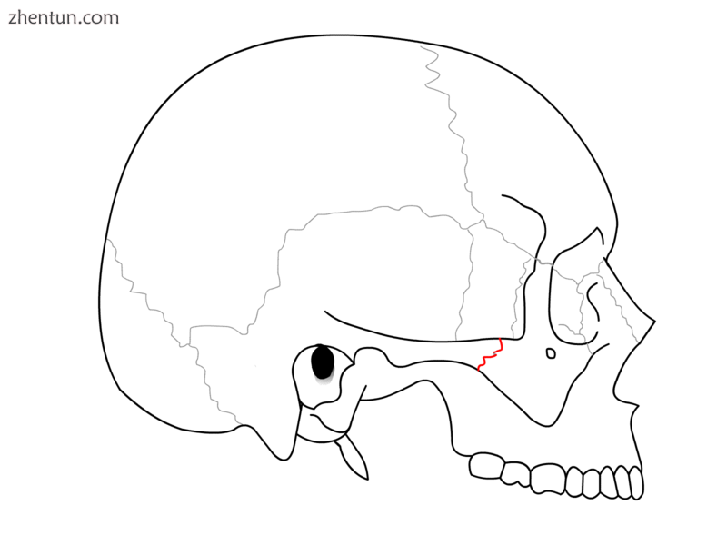 Zygomaticotemporal suture.png