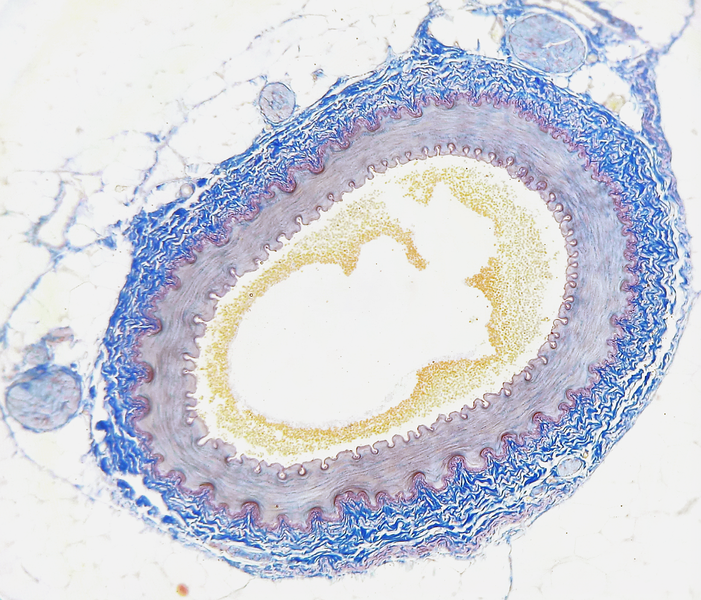 Cross section of a human artery.png