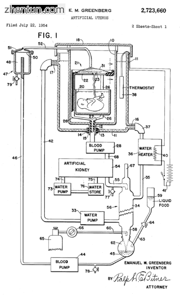Illustration of an artificial womb patented by Emanuel M Greenberg in 1955..png