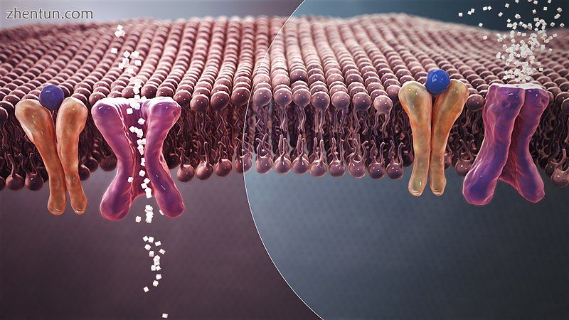 Reduced insulin secretion and absorption leads to high glucose content in the blood..jpg