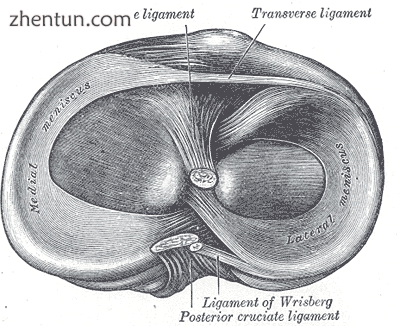 Head of right tibia seen from above, showing menisci and attachments of ligaments..png