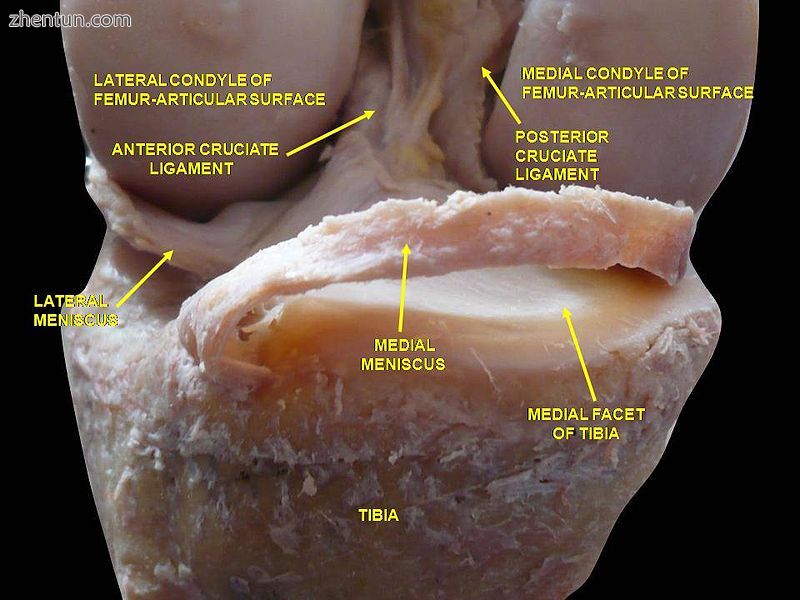 Knee joint. Deep dissection. Anterior view.JPG