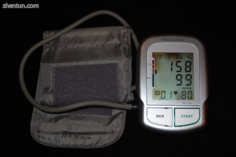 Automated arm blood pressure meter showing arterial hypertension (shown a systol.jpg