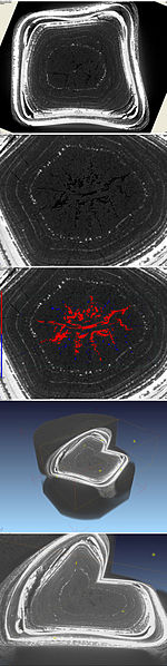 X-ray microtomograph of a gallstone.jpg