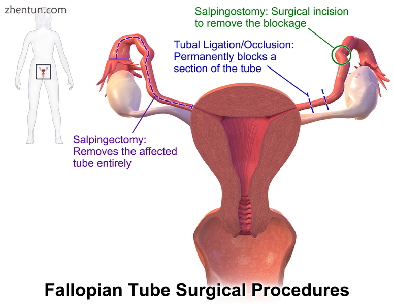 Locations of some surgical procedures.png